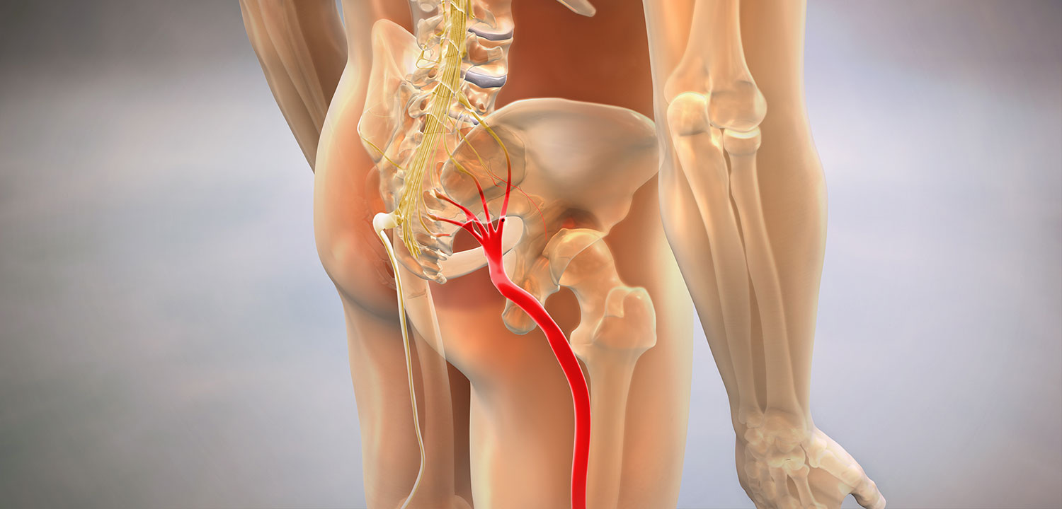 Sciatica Pain Treatment Physiotherapy Bolton Lancashire Sciatica Pain Treatment Physiotherapy Bolton Lancashire